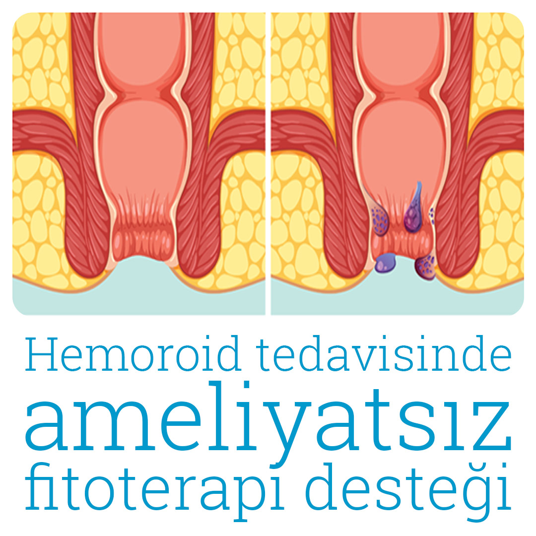 Dr. Hakan Özkul Kanser Tedavisi