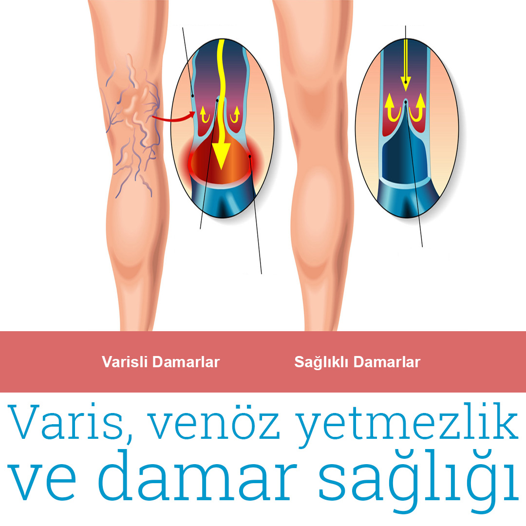 Dr. Hakan Özkul Kısırlık Tedavisi